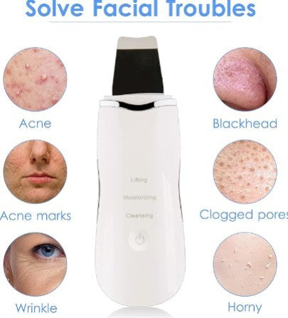 3-in-1 Ultrasonic Facial Skin Scrubber – Deep Pore Cleansing & Lifting Device