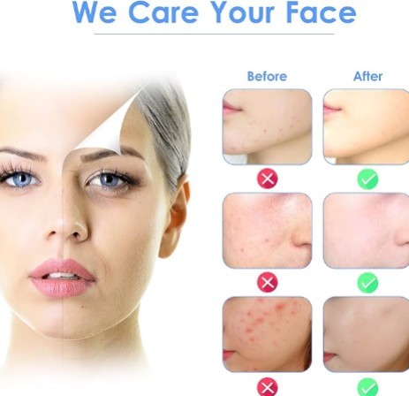 3-in-1 Ultrasonic Facial Skin Scrubber – Deep Pore Cleansing & Lifting Device